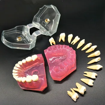 Dantų Studijų Mokymo Modelį Standartinis Modelis, Nuimamas Dantų Minkšta Guma SUAUGUSIŲJŲ TYPODONT Modelis