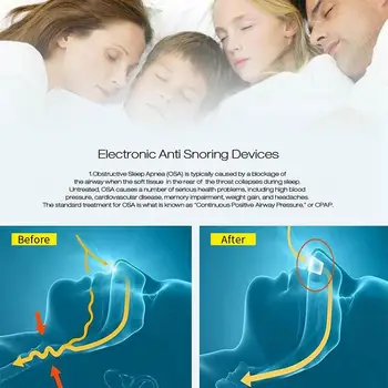 Naujas Kovos Knarkimas Įtaisas Snore Kamščiu, Stabdžių Snore Nosies Įrašą Stabdžių Snore Nosies Dilators Kvėpavimo Aparatai Miego Pagalbos Įranga