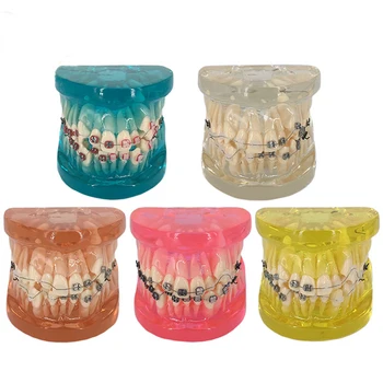 NSKLED Dantų Implantai Dantų Ligos Modelis su Restauravimo Tiltas Dantis Už Medicinos Mokslo Liga Mokymo Studijų Dantų Menas