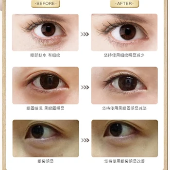 Prekės raukšlių stumkite kamuolys akis BB kremas anti-paburkimą finelines magic eye odos esmė priežiūros anti-senėjimo esmė akis priežiūra