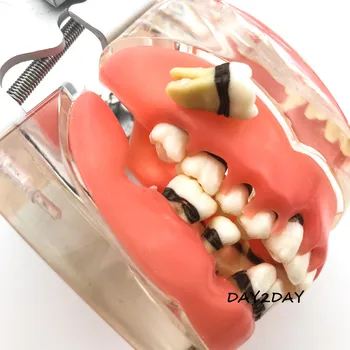 Suaugusiųjų Patologinių Periodonto ligų #4017 Burnos Švietimo Dantų Studijų Dantys Modelis